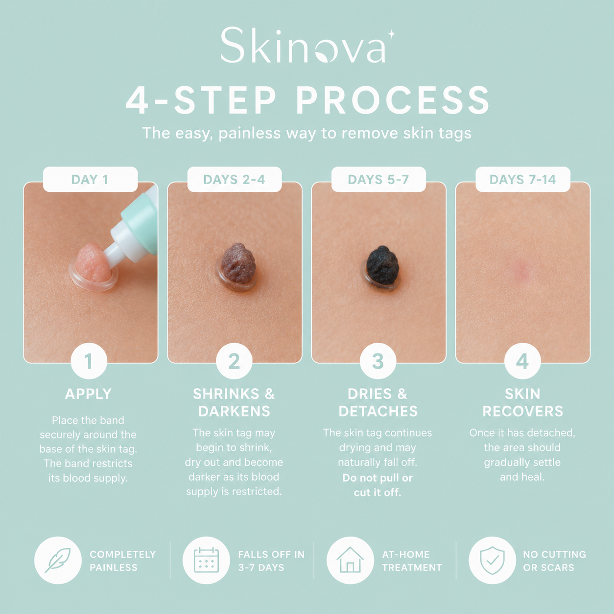 Tagova Skin Tag Remover